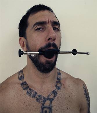 Brace Gag