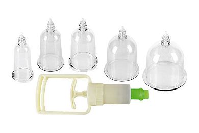 Chinese Cupping Set - mit 5 Cups und Handpumpe