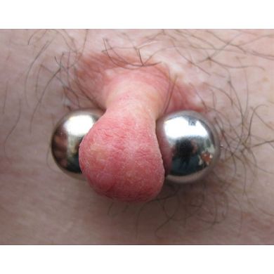MisterB Nippelklemmen