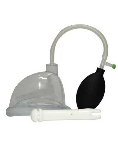 Frhle: Intimsaugschalen-Set 4-tlg.