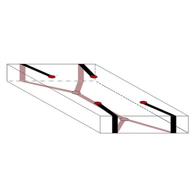 bettfesseln